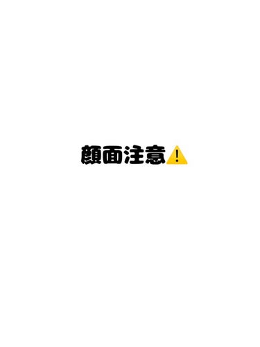 【転倒後3日目】

顎の腫れがだいぶひいたので口を大きく開けても痛くはなくなりました😭
ただ、まだ腫れてはいるので妙に顔が長い感じがします…
そして押すとやはり痛いです……

擦り傷のほうは、滲出液があ