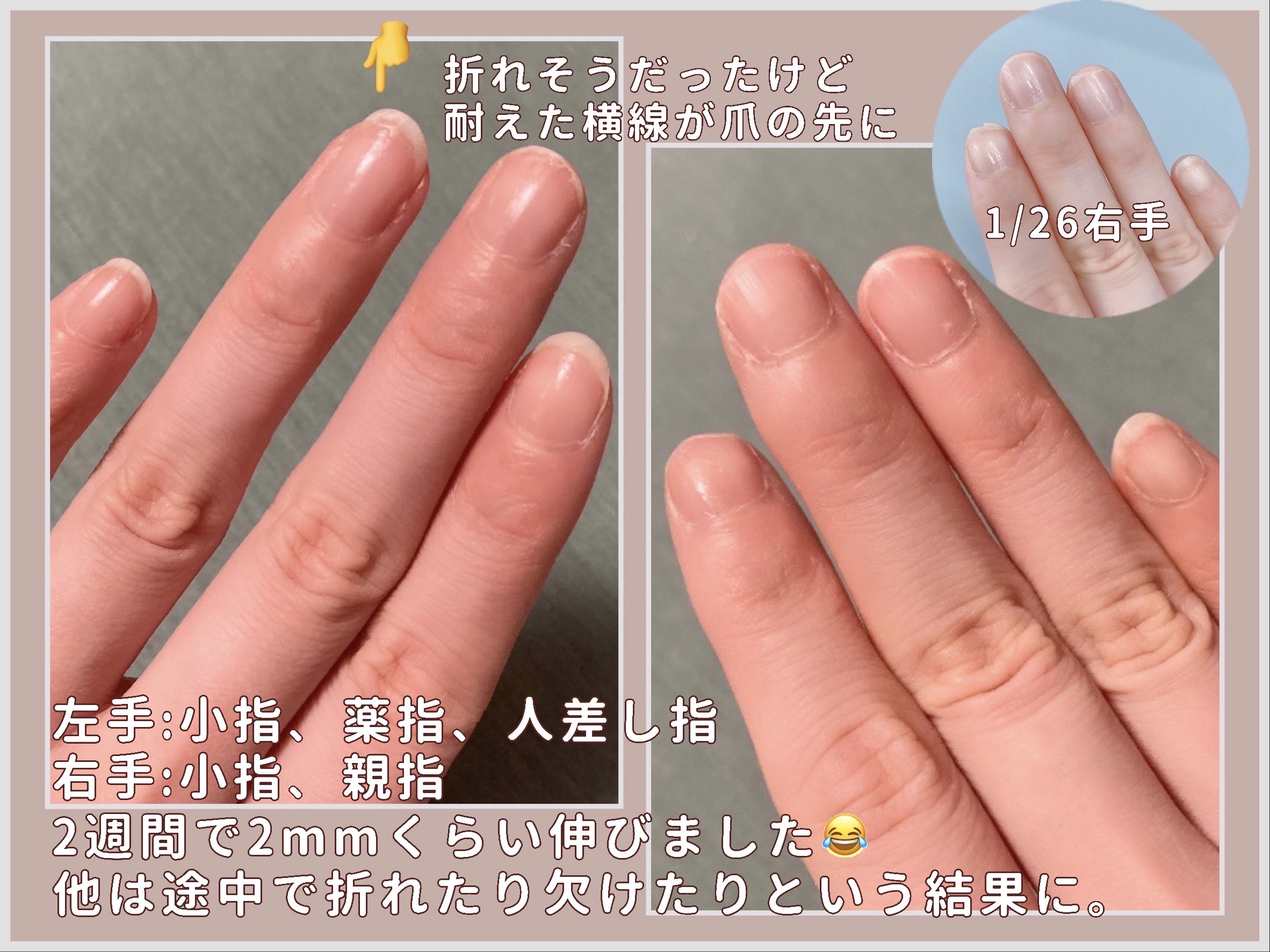 エテュセ クイックケアコート/ettusais/ネイルオイル・トリートメントを使ったクチコミ（2枚目）