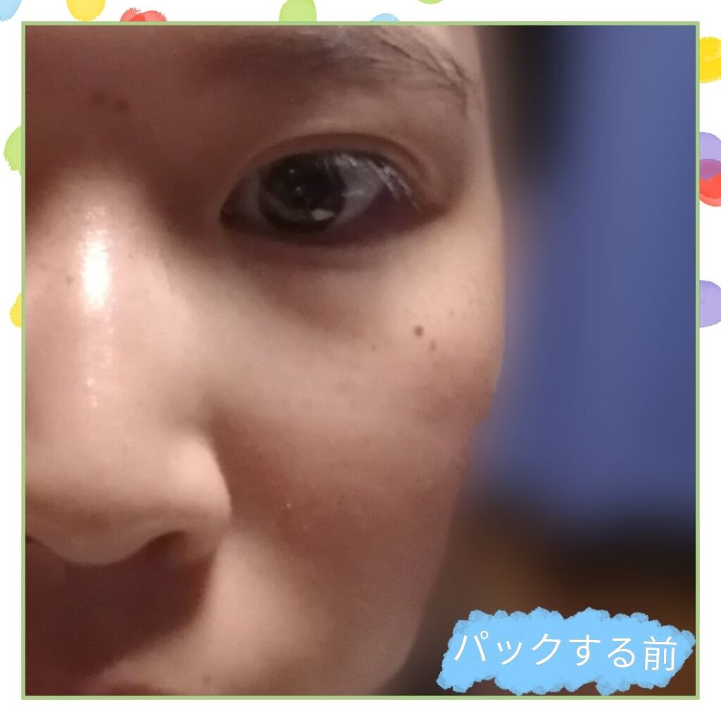 ごめんね素肌マスク/クリアターン/シートマスク・パックを使ったクチコミ(3枚目)