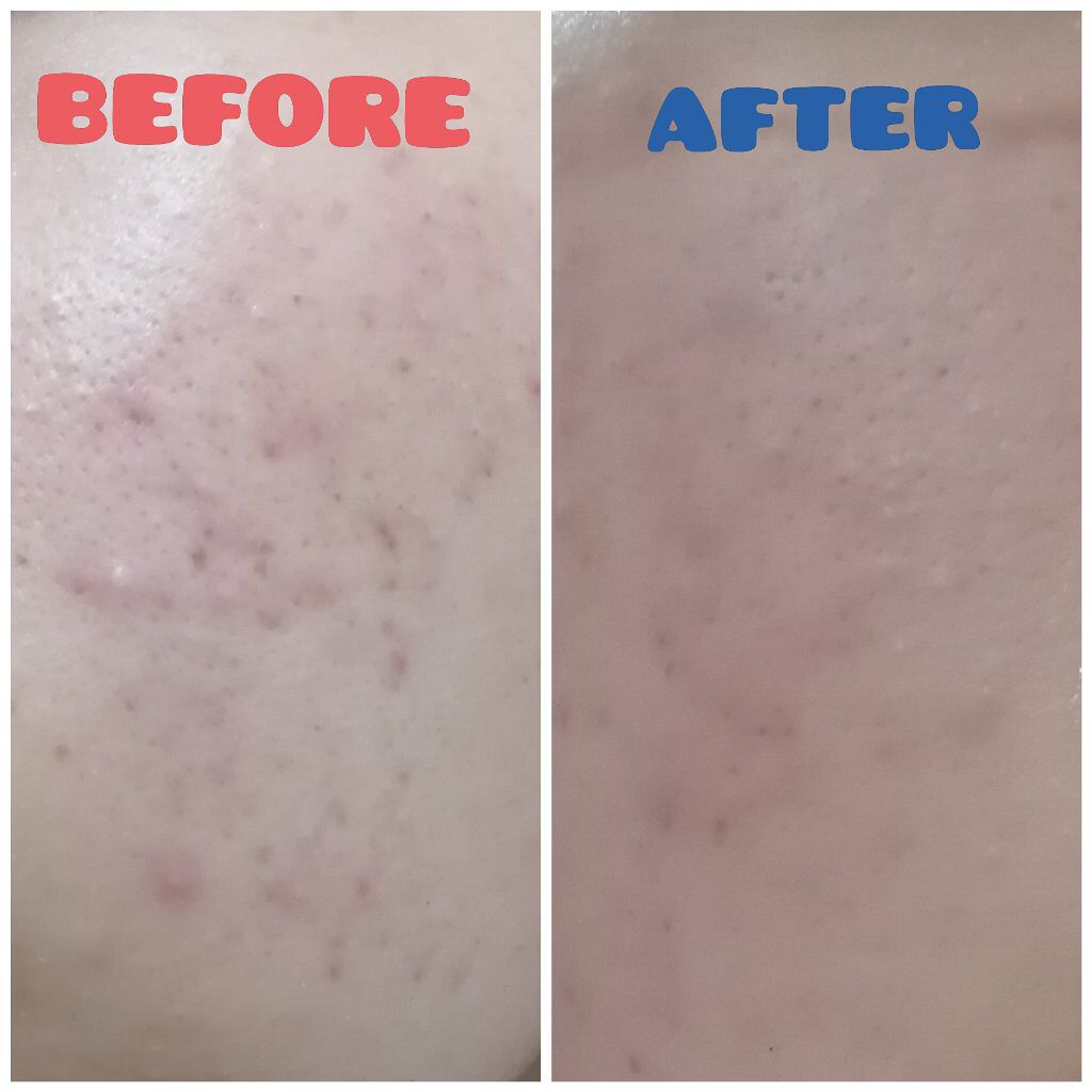 マイルド＆モイスチャーアロエジェル/ネイチャーリパブリック/ボディローションを使ったクチコミ（3枚目）