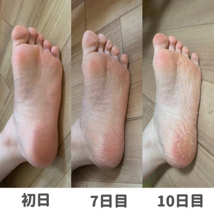 ベビーフット/リベルタ/その他キットセットを使ったクチコミ(4枚目)