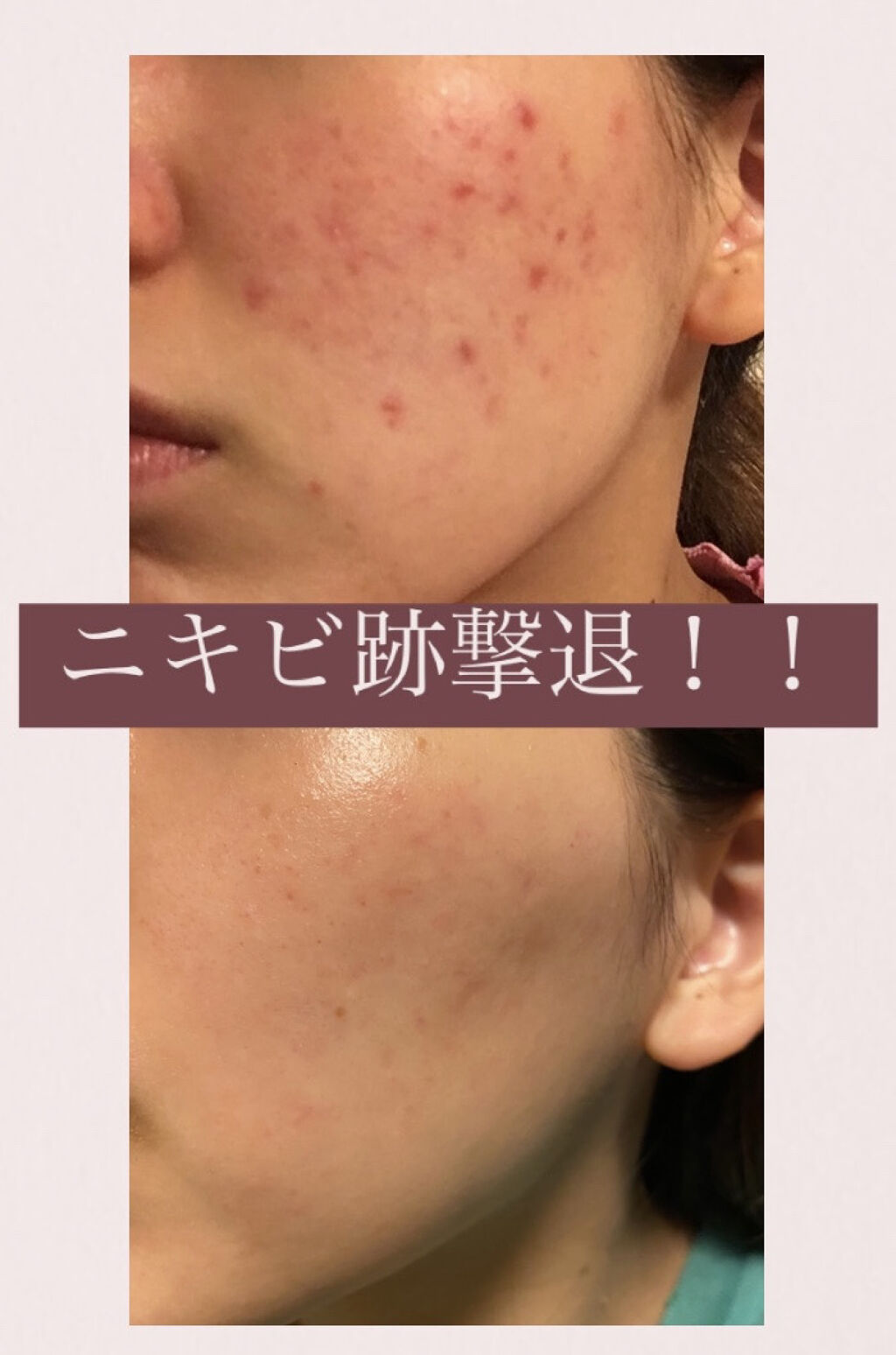 ビジャ シカバーム EX/innisfree/フェイスバームを使ったクチコミ（1枚目）