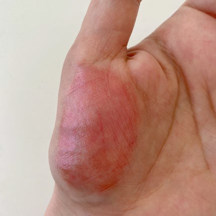 リップケア バーム/キュレル/リップバームを使ったクチコミ(6枚目)