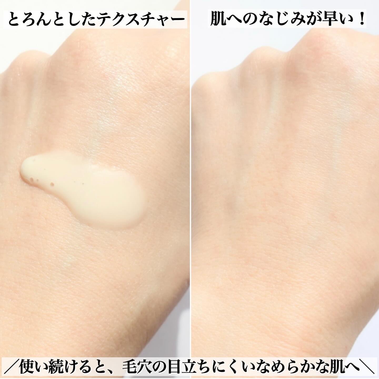 ユース ラディアンス ビタチノール セラム/primera/美容液を使ったクチコミ（3枚目）