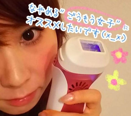 光美容器KE-NON(ケノン)/エムテック/家庭用脱毛器を使ったクチコミ(1枚目)