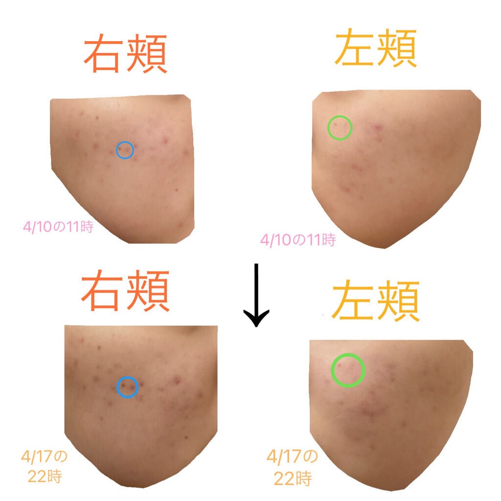 マデカソ CICAクリーム /A’pieu/フェイスクリームを使ったクチコミ(2枚目)