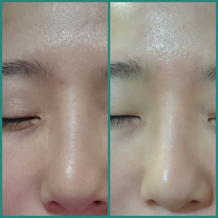 ドクタージャルト シカペア クリーム (第2世代)/Dr.Jart+/フェイスクリームを使ったクチコミ(4枚目)