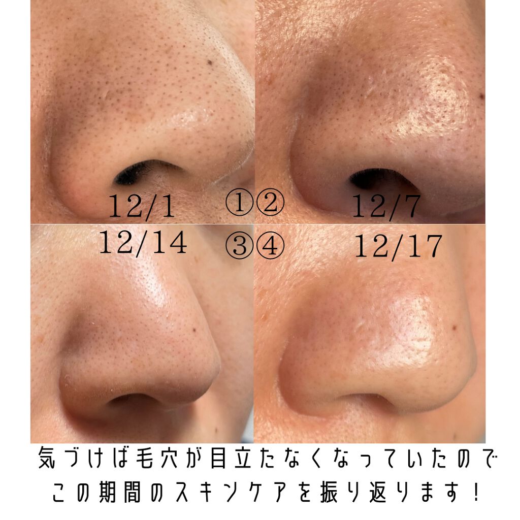 フルフィットプロポリスシナジートナー/COSRX/化粧水を使ったクチコミ(2枚目)