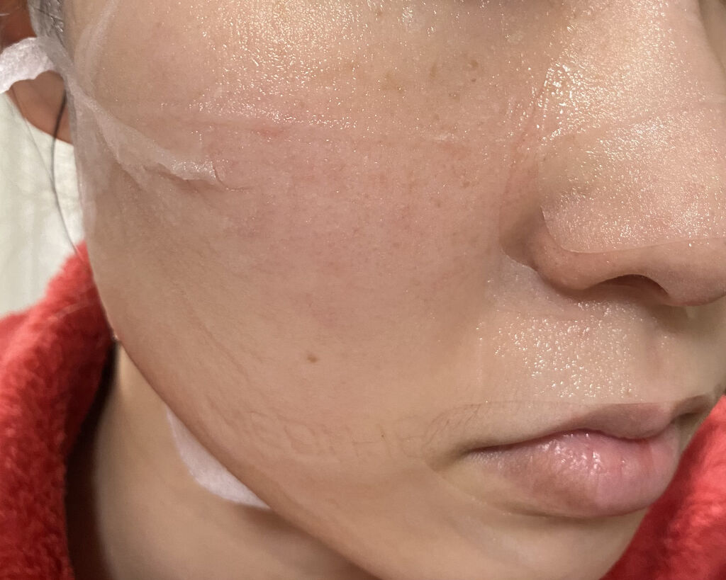 N.M.FアクアアンプルマスクJEX/MEDIHEAL/シートマスク・パックを使ったクチコミ（2枚目）