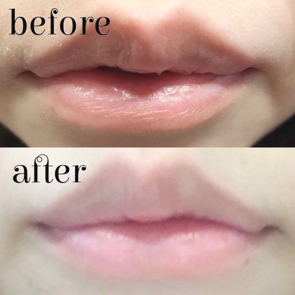 リップケア クリーム/キュレル/リップクリームを使ったクチコミ（2枚目）