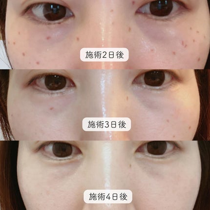 を使ったクチコミ(2枚目)