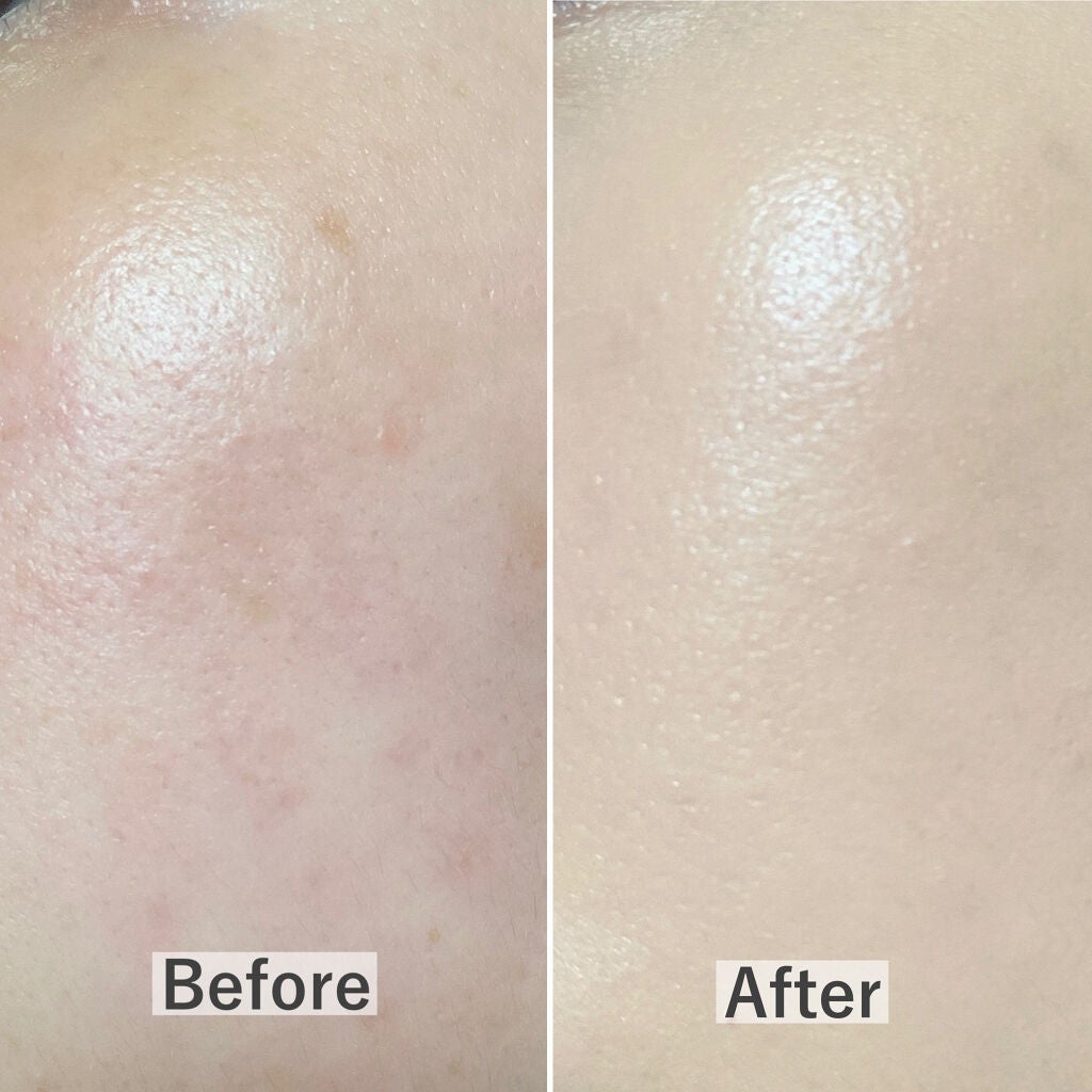 ピンクティーツリーカバークッション/APLIN/クッションファンデーションを使ったクチコミ(4枚目)