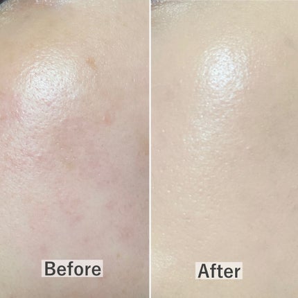 ピンクティーツリーカバークッション/APLIN/クッションファンデーションを使ったクチコミ(4枚目)