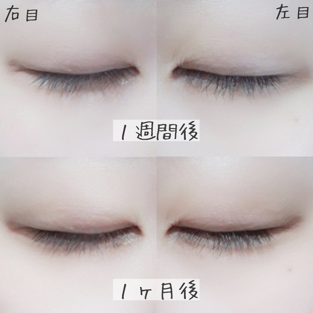 EMAKED(エマーキット)/水橋保寿堂製薬/まつげ美容液を使ったクチコミ(3枚目)