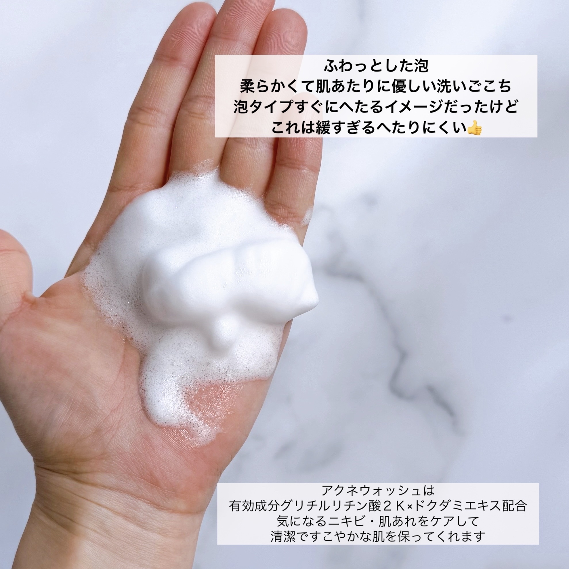 ロゼット洗顔サボン アクネウォッシュ【医薬部外品】[泡洗顔料]/ロゼット/泡洗顔を使ったクチコミ（3枚目）