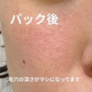 キールズ エッセンス ジェルマスク CL/Kiehl's/洗い流すパック・マスクを使ったクチコミ（6枚目）