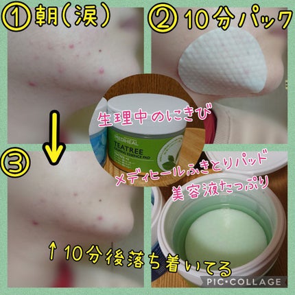 ティーツリーカーミングエッセンスパッド/MEDIHEAL/トナーパッドを使ったクチコミ(1枚目)