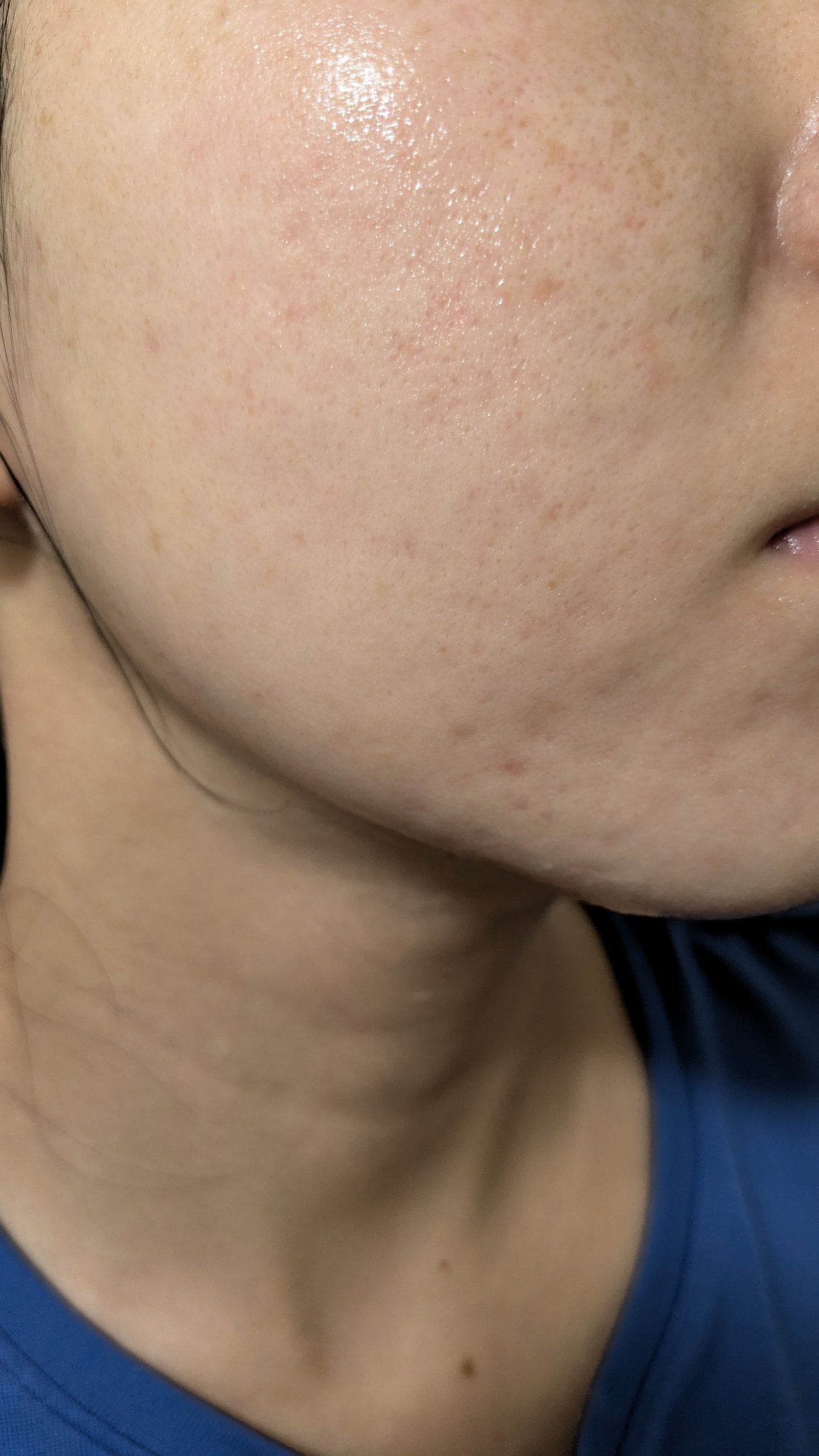 A2+NAG2ソリューション/The Ordinary/美容液を使ったクチコミ（1枚目）