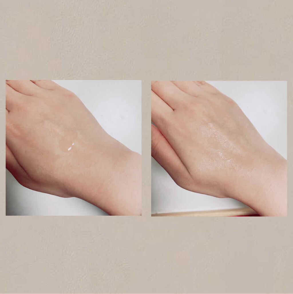 ミノン アミノモイスト 薬用アクネケア ローション/ミノン/化粧水を使ったクチコミ（2枚目）