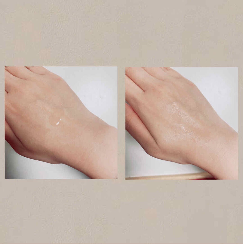 ミノン アミノモイスト 薬用アクネケア ローション/ミノン/化粧水を使ったクチコミ(2枚目)