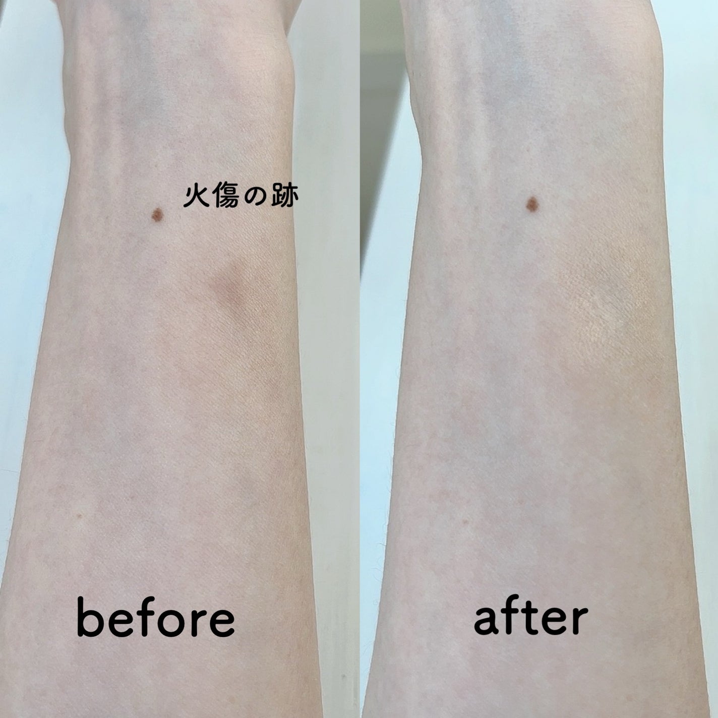 ダーマシンコンシーラー/23years old/リキッドコンシーラーを使ったクチコミ(4枚目)