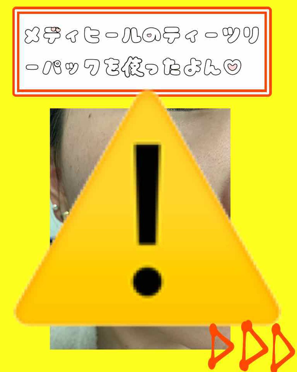 ティーツリーケア ソリューション エッセンシャルマスクEX/MEDIHEAL/シートマスク・パックを使ったクチコミ(1枚目)