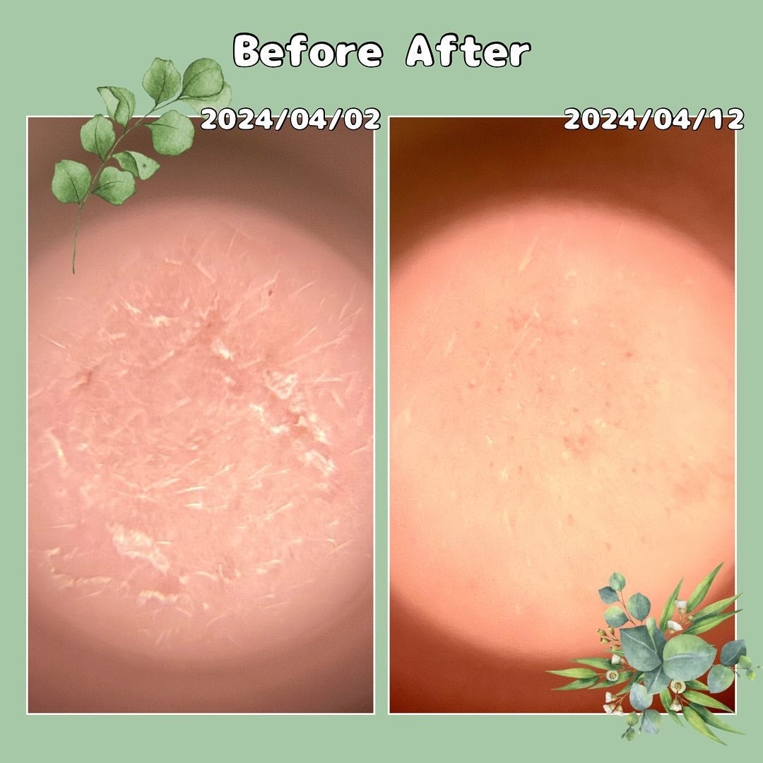 プロCICAリードルショット100/VT/ブースター・導入液を使ったクチコミ(4枚目)