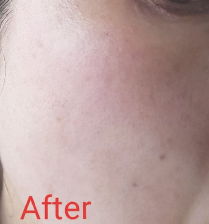 エリクシール シュペリエル つや玉ミスト/エリクシール/ミスト状化粧水を使ったクチコミ(3枚目)