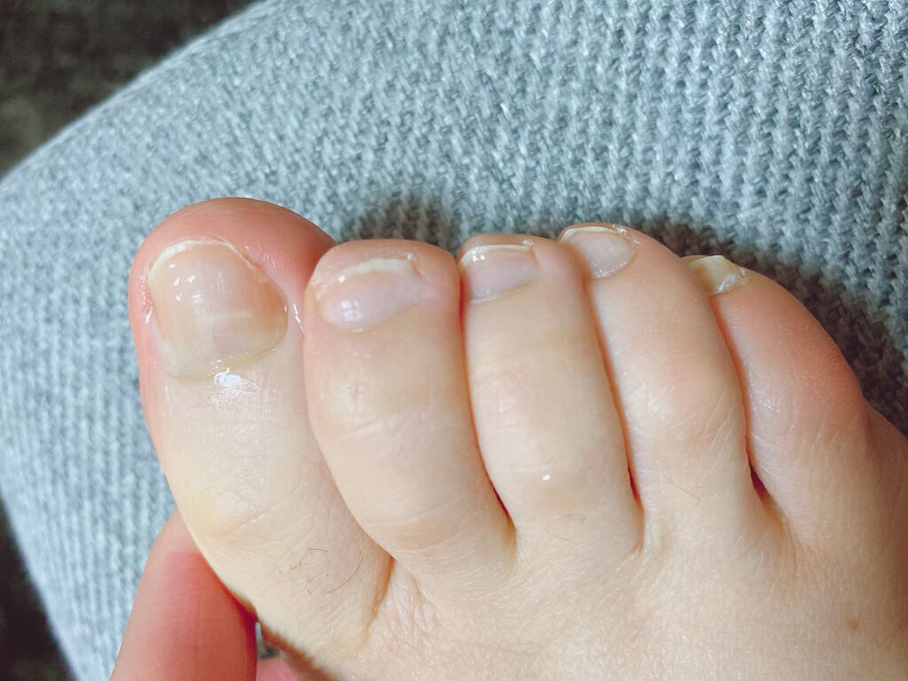 薬用 クリアストロングショット アルファ/北の快適工房/レッグ・フットケアを使ったクチコミ(3枚目)