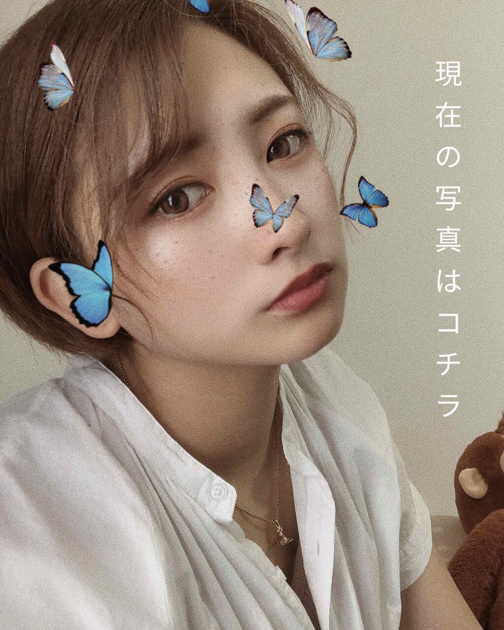 ぞの on LIPS 「わたくし二重整形しました。湘南美容外科福岡院で施術して頂きまし..」(2枚目)