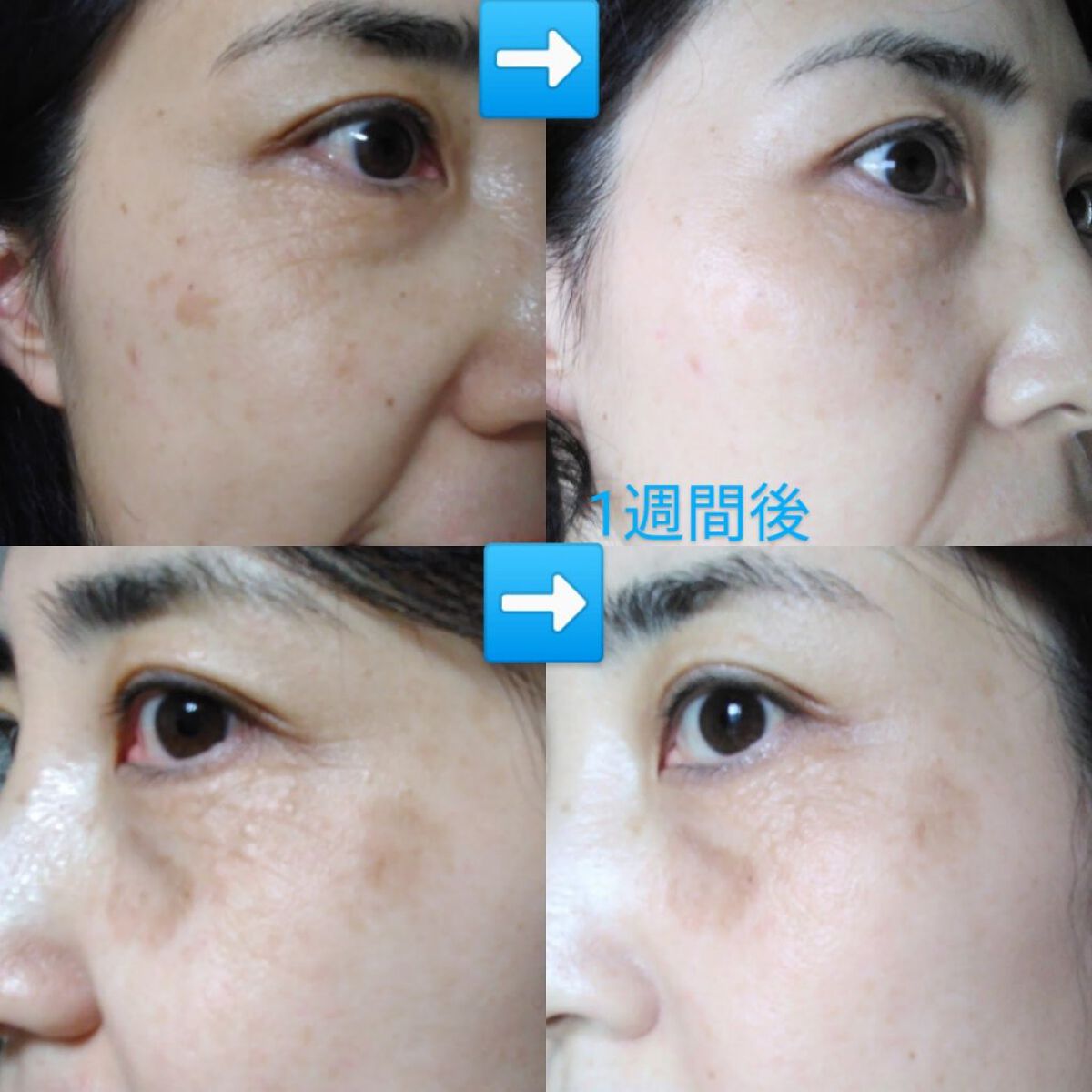 アイクリーム ; コンセントレートオン/Huxley/アイケア・アイクリームを使ったクチコミ（3枚目）