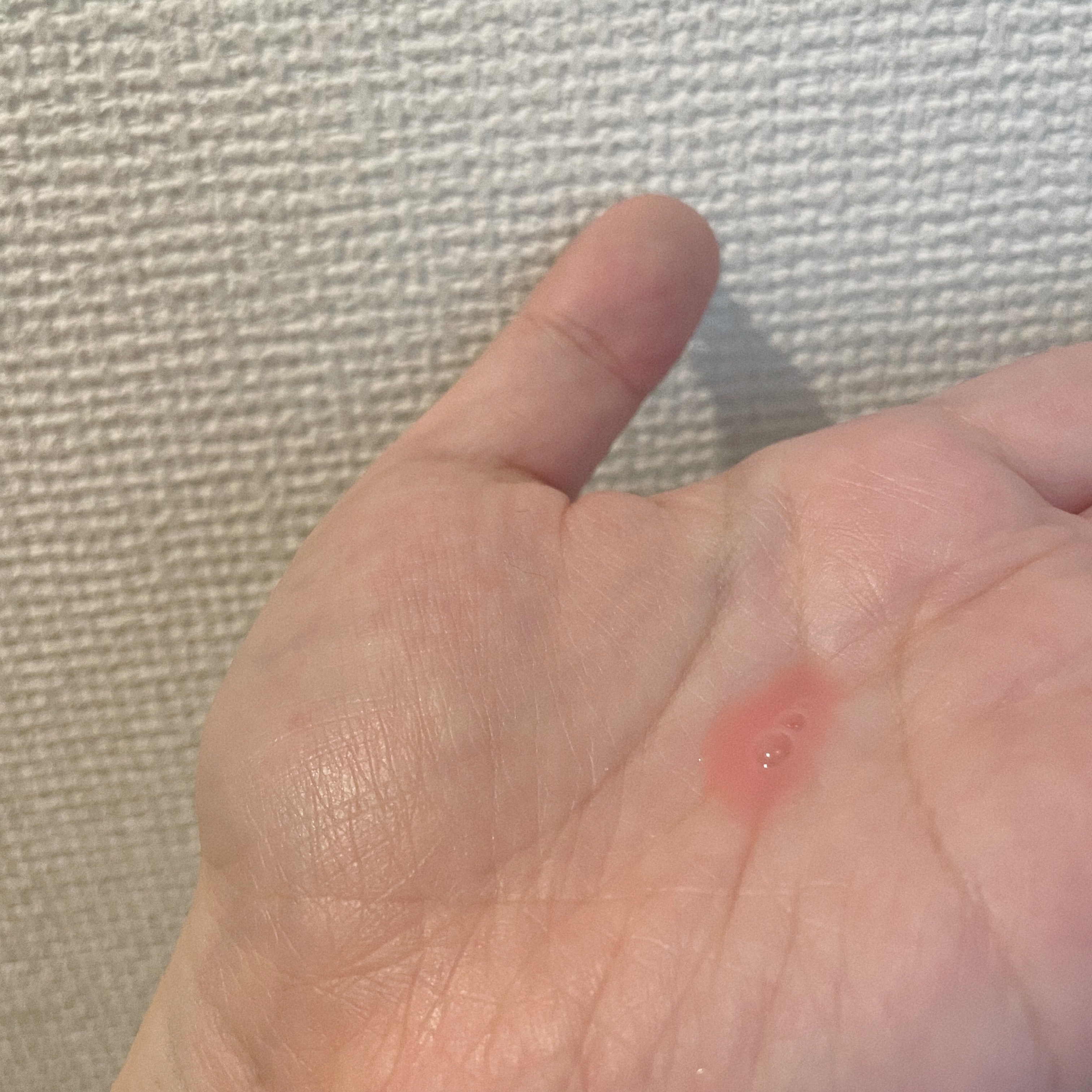 PDRNピンクアンプル PDRN 10,000ppm配合/MEDICUBE/美容液を使ったクチコミ（2枚目）