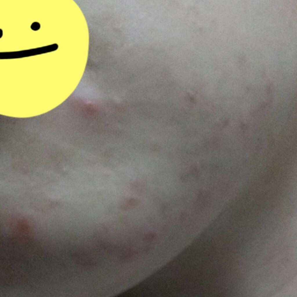 Chigusa._.紅羽千草 on LIPS 「【助けてください(泣)】こんにちは千草です、わたしは中2あたり..」(3枚目)