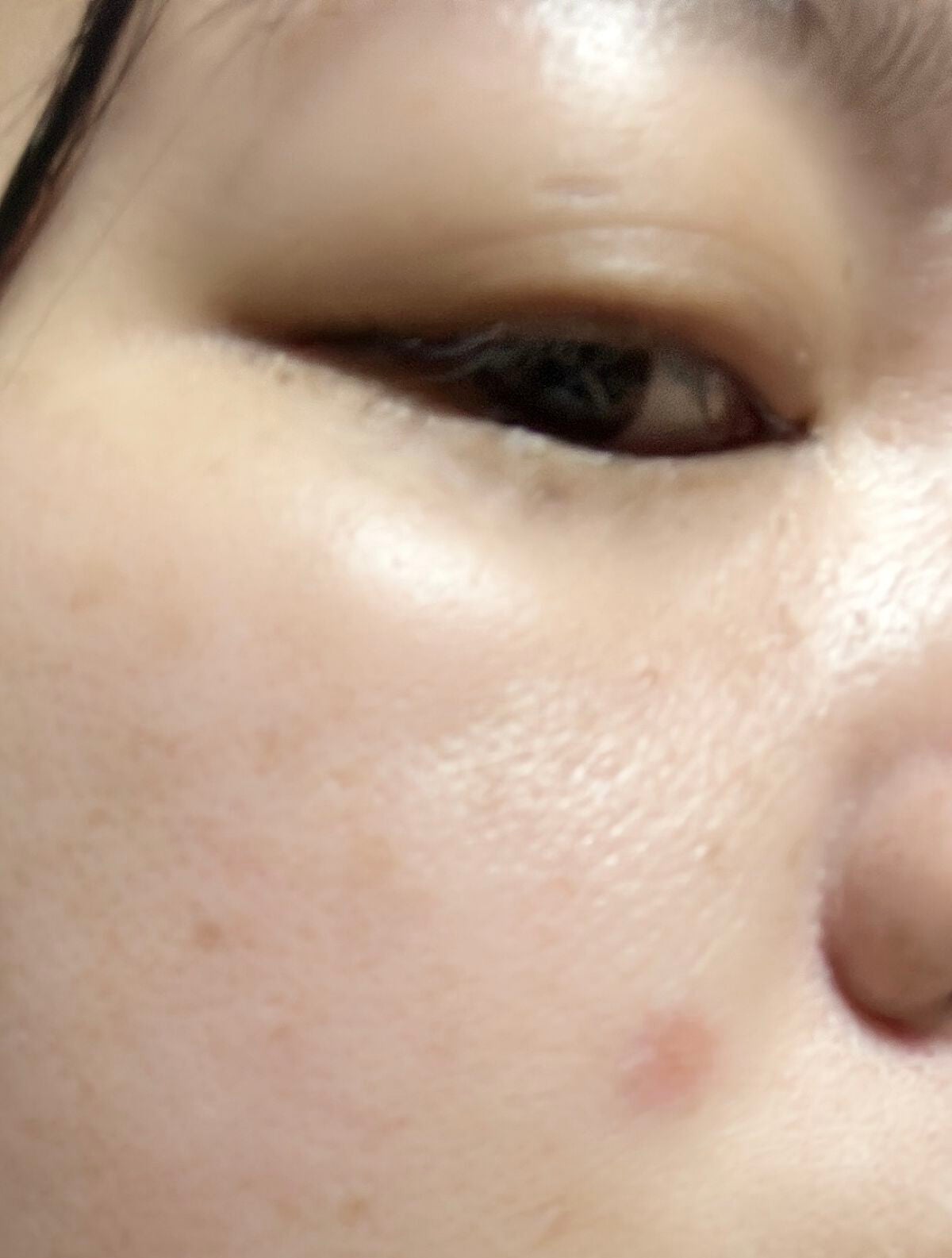 プロCICA クリアスポットパッチ/VT/その他スキンケアを使ったクチコミ(1枚目)