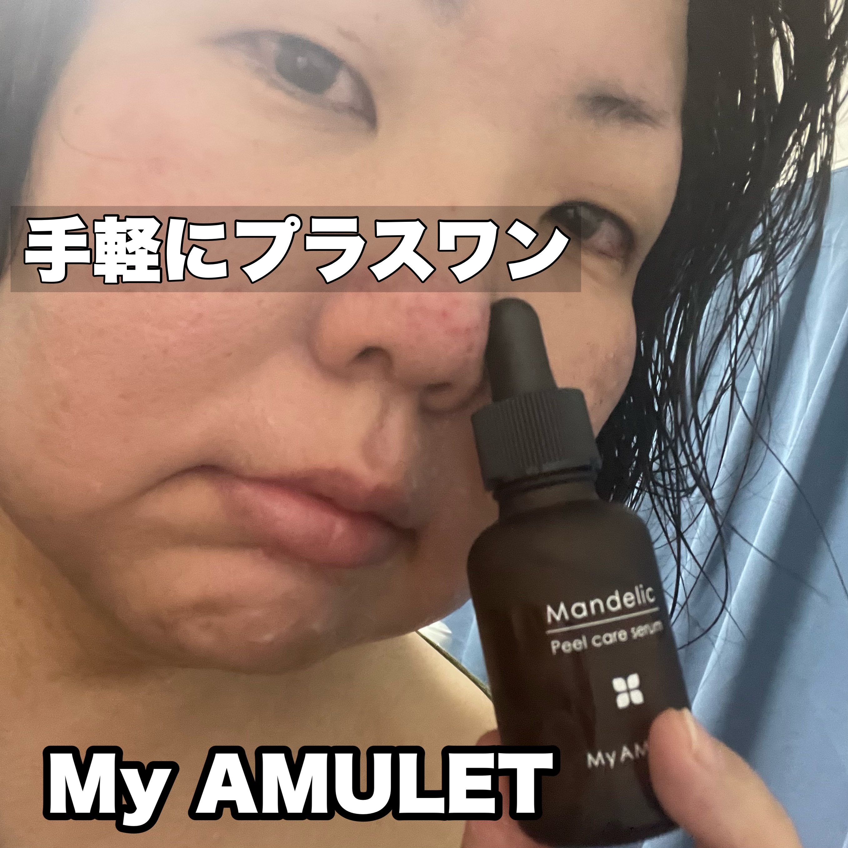 ピールケアセラム/My AMULET/美容液を使ったクチコミ（1枚目）