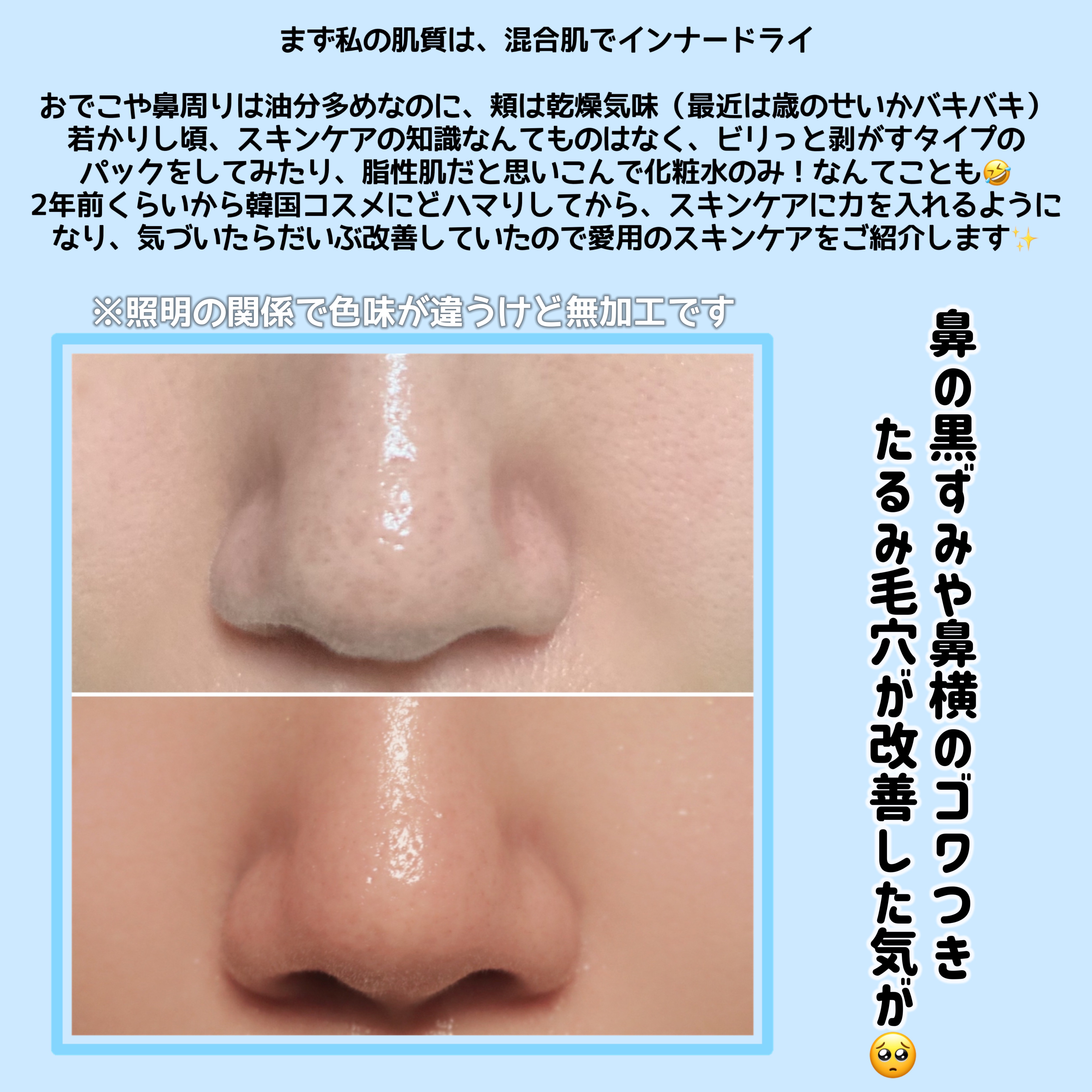 緑豆弱酸性クレンジング/beplain/クレンジングクリームを使ったクチコミ（2枚目）