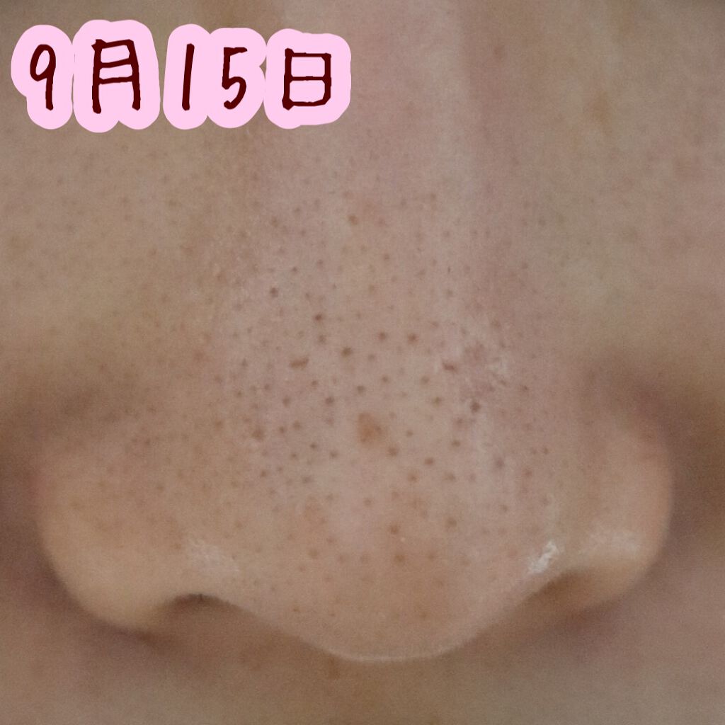 デュオ ザ クレンジングバーム ブラック/DUO/クレンジングバームを使ったクチコミ(4枚目)