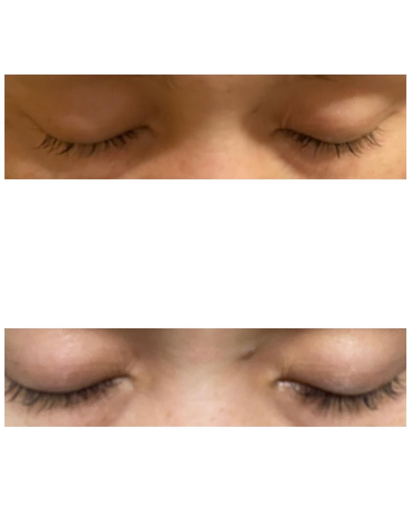 Lash drip アイラッシュセラム/Lash drip/まつげ美容液を使ったクチコミ（2枚目）