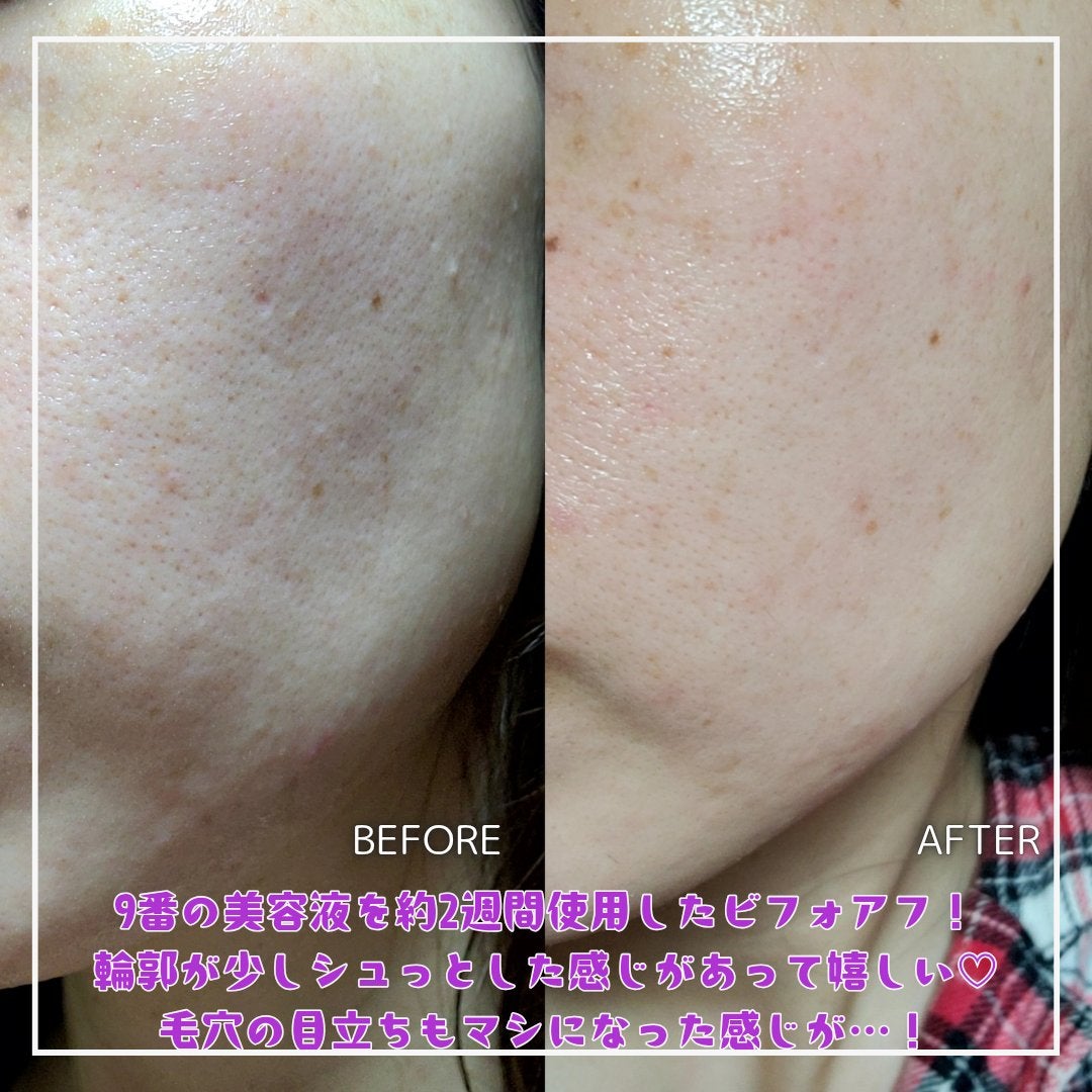 9番 NMNバイオリフト濃縮美容液/numbuzin/美容液を使ったクチコミ(2枚目)