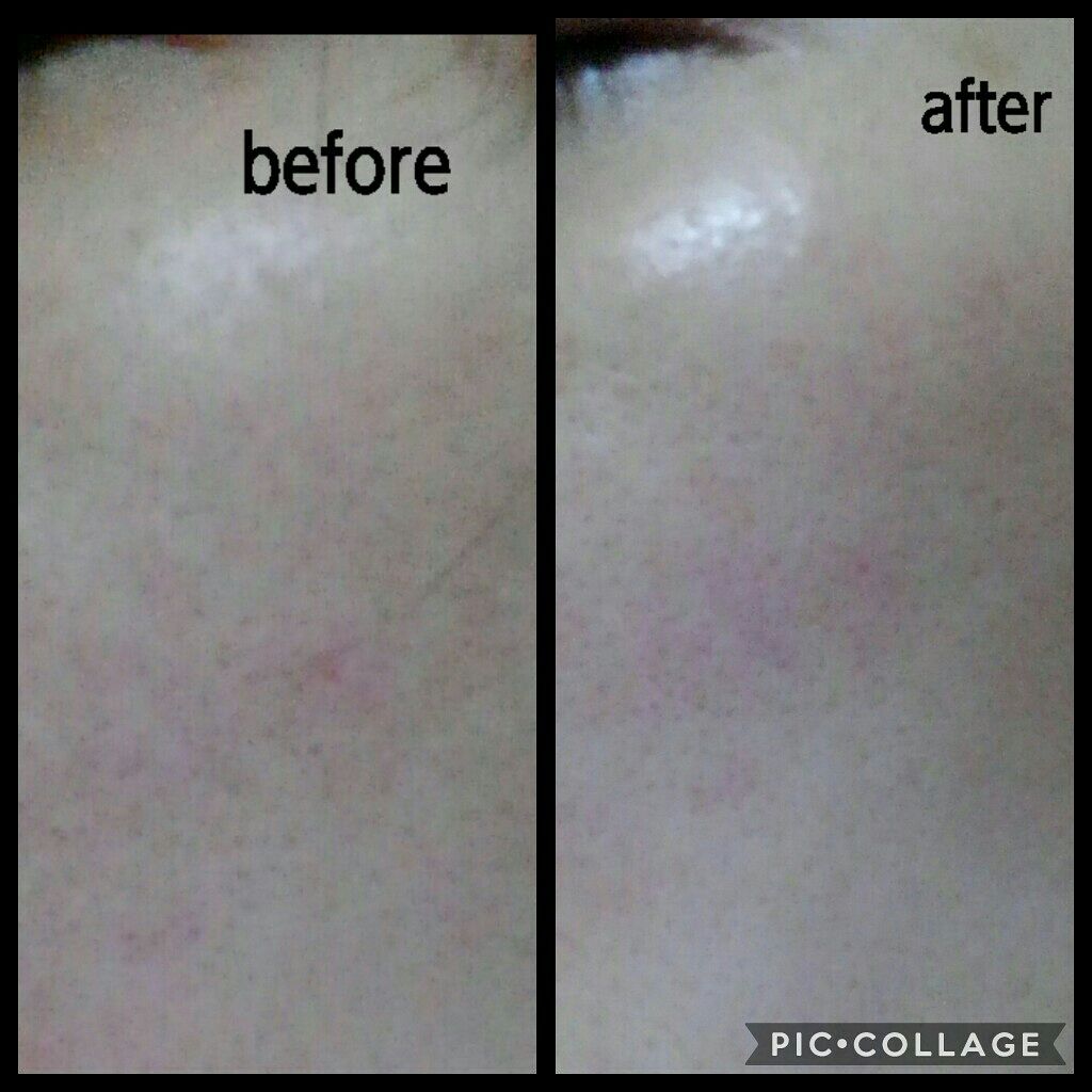 NO.1アクアクリーナー/素肌に還る なちゅRe:/化粧水を使ったクチコミ(4枚目)