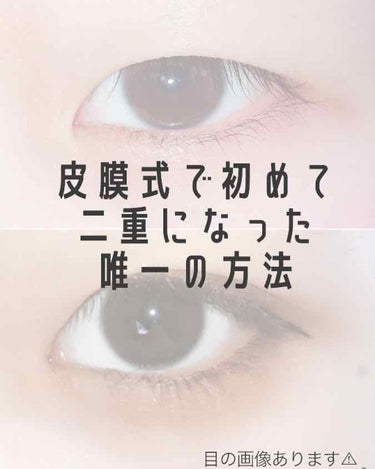 ROYAL ローヤルプチアイムS (スーパーハードタイプ)のクチコミ「折式、ルドゥーブルのような皮膜式のアイテープ、アイテープ、メザイクでは二重にならなかった私の二.....」（1枚目）