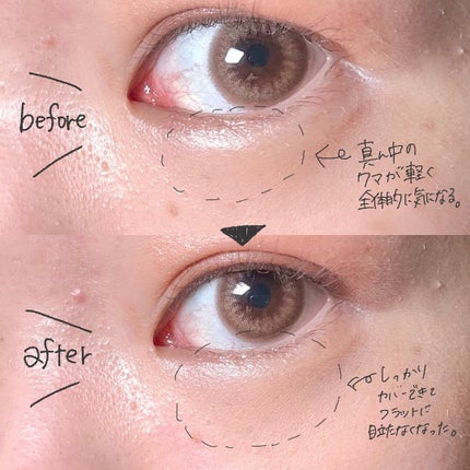 アイレノール クマクリーム/IRENOL/アイケア・アイクリームを使ったクチコミ(4枚目)