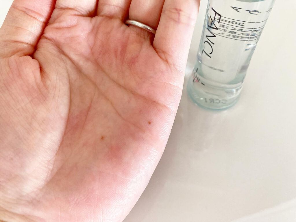 FDR アクネケア 化粧液/ファンケル/化粧水を使ったクチコミ（2枚目）