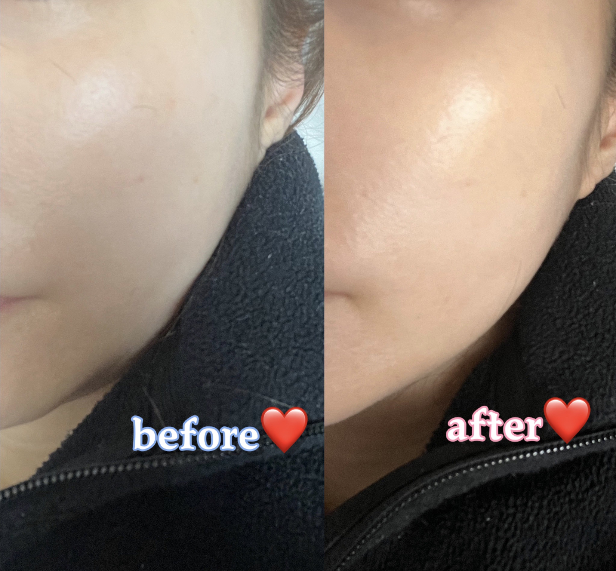 シルキースティックファンデーション ベージュ/KAMIKA/その他ファンデーションを使ったクチコミ（3枚目）