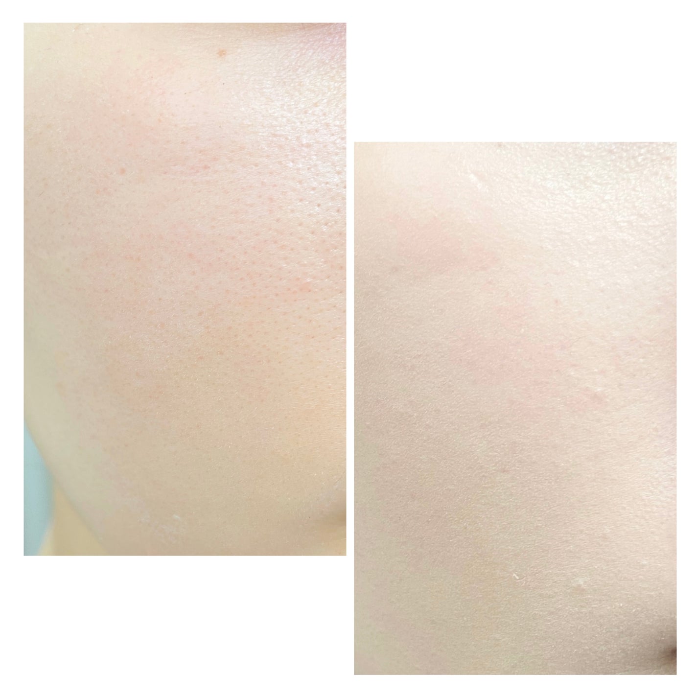 ピンクティーツリーカバーアップグロウクッション/APLIN/クッションファンデーションを使ったクチコミ(4枚目)