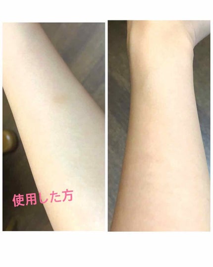 ホワイトアップ ローション(II)/アクアレーベル/化粧水を使ったクチコミ(1枚目)