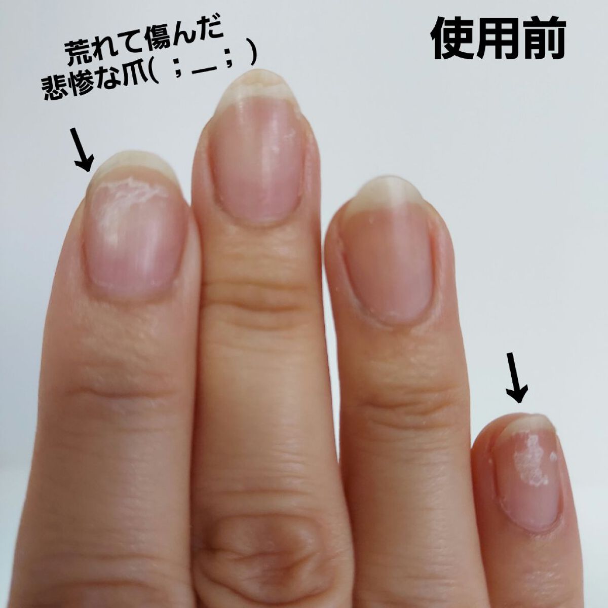 グロウケアコート/デュカート/ネイルオイル・トリートメントを使ったクチコミ（2枚目）