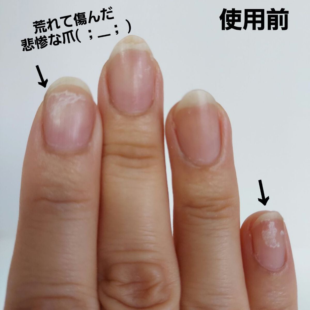 グロウケアコート/デュカート/ネイルオイル・トリートメントを使ったクチコミ(2枚目)