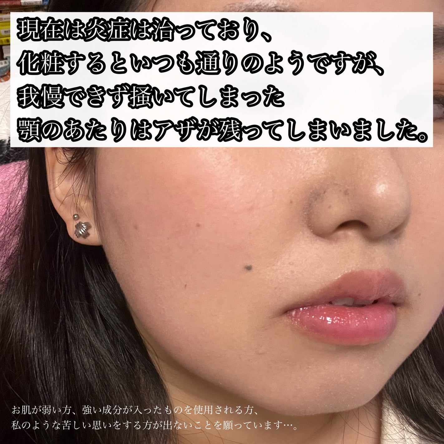 ナイちゃん on LIPS 「「季節の変わり目だし、乾燥しないようにスキンケアを見直そう!」..」(5枚目)