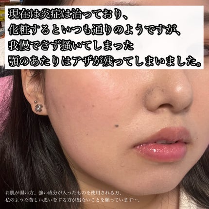 ナイちゃん on LIPS 「「季節の変わり目だし、乾燥しないようにスキンケアを見直そう!」..」(5枚目)